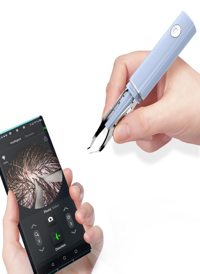 scopepick Hair Removal Tweezer with 1080p Camera, Ultimate Precision: Tweezer with Camera - Perfect for Delicate Tasks! - - Ear Hair Eyebrow Tweezer - Image 1